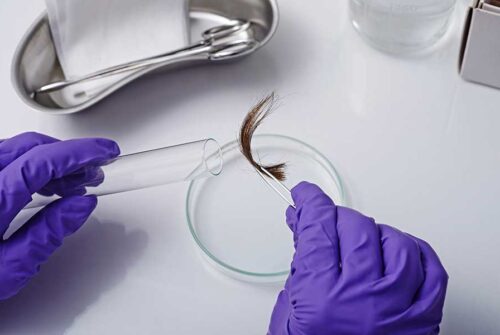 Drug abuse tests with hair follicle