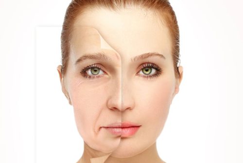 Embracing Timeless Beauty with a facelift